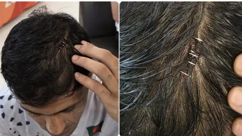 বক্সার সালিমের সাহসিকতা ও জেদ