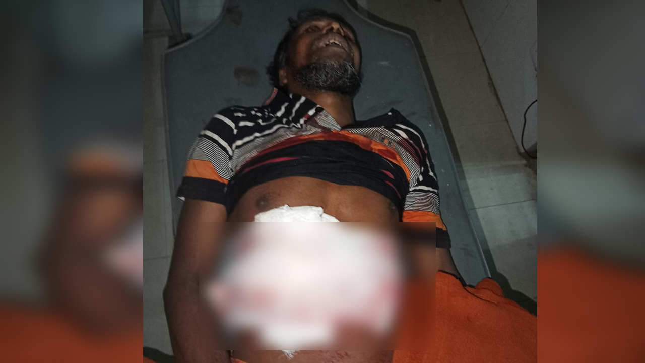 উখিয়ায় প্রতিবেশীর ছুরিকাঘাতে রোহিঙ্গার মৃত্যু