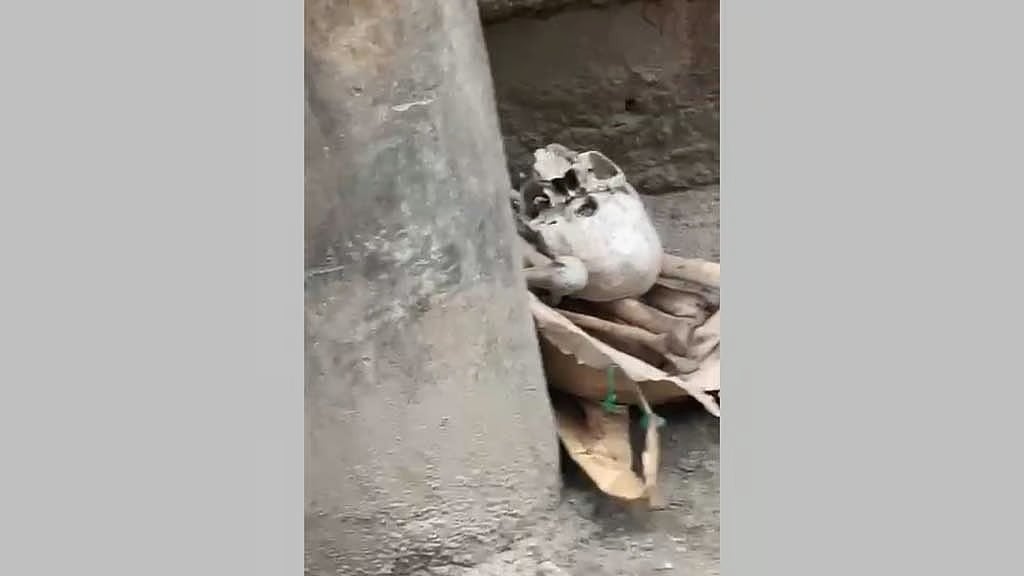 রাজধানীর সড়কে মিলল মানুষের হাড়-খুলি