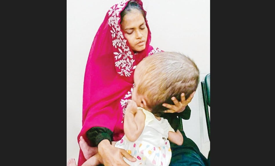 দুই বছরের শিশুর মাথার ওজন ১২ কেজি
