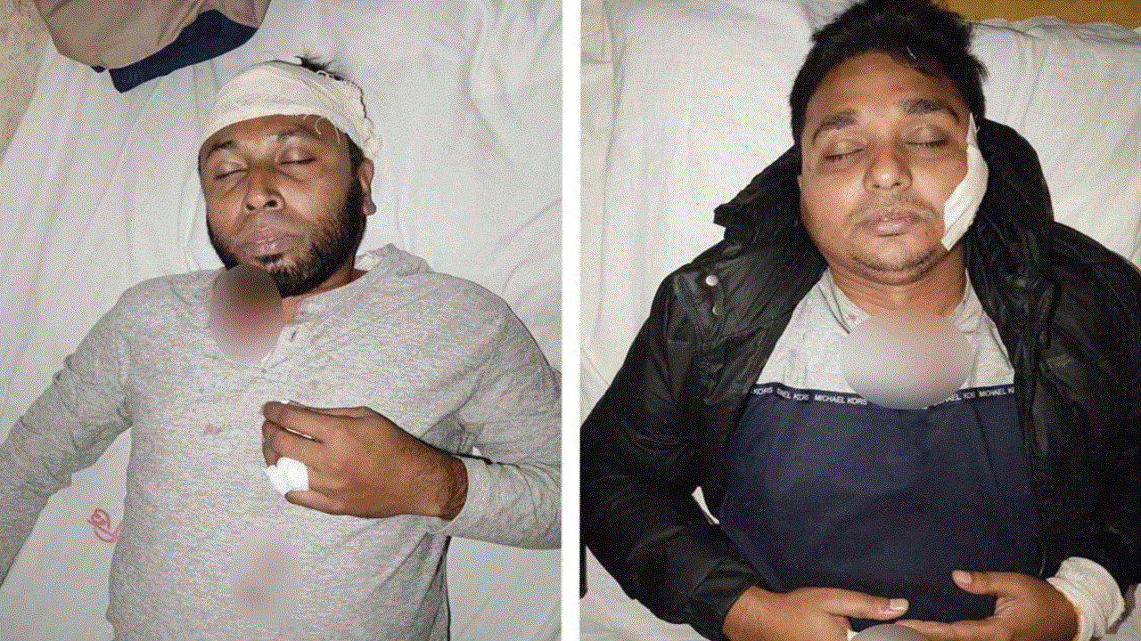 আসামি ধরতে গিয়ে হামলার শিকার পুলিশ