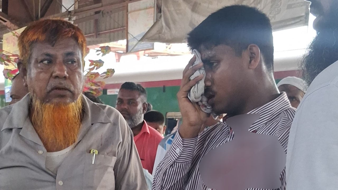 চলন্ত ট্রেনে পাথর নিক্ষেপ, চোখ হারালেন শিক্ষার্থী