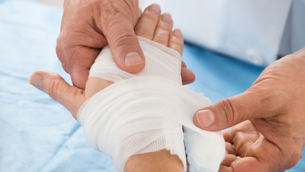 আগুনে পোড়া রোগীর স্পিচ অ্যান্ড ল্যাঙ্গুয়েজ থেরাপি