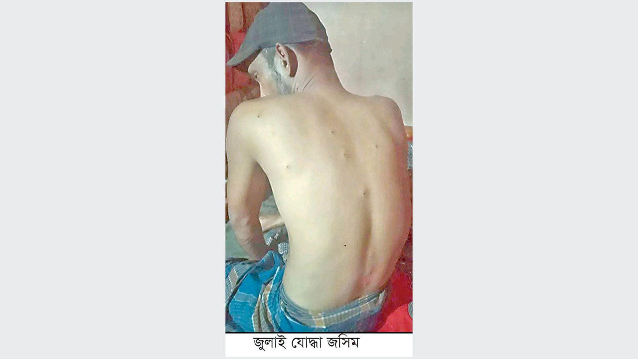 অর্থাভাবে অপারেশন করাতে পারছেন না জসিম