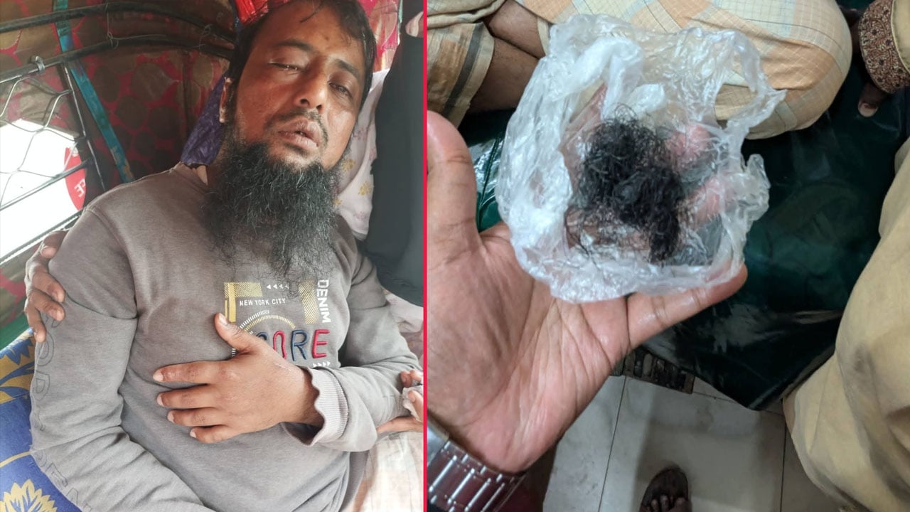 ফেনীতে জামায়াত কর্মীকে দাড়ি ধরে লাঠিপেটা, স্ত্রীকে হেনস্তার দাবি