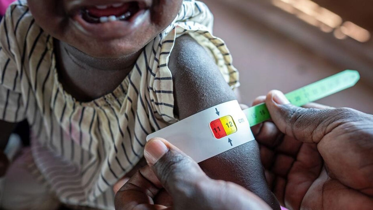 বিশ্বের খাদ্য সংকটে থাকা দুই-তৃতীয়াংশ মানুষ ১০ দেশে, তালিকায় বাংলাদেশ