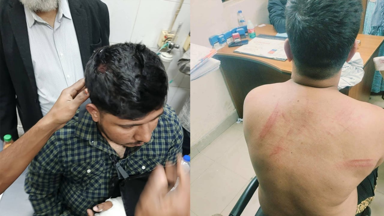 সুনামগঞ্জে ‘জুলাই যোদ্ধা’ ইমনদ্দোজার ওপর হামলা