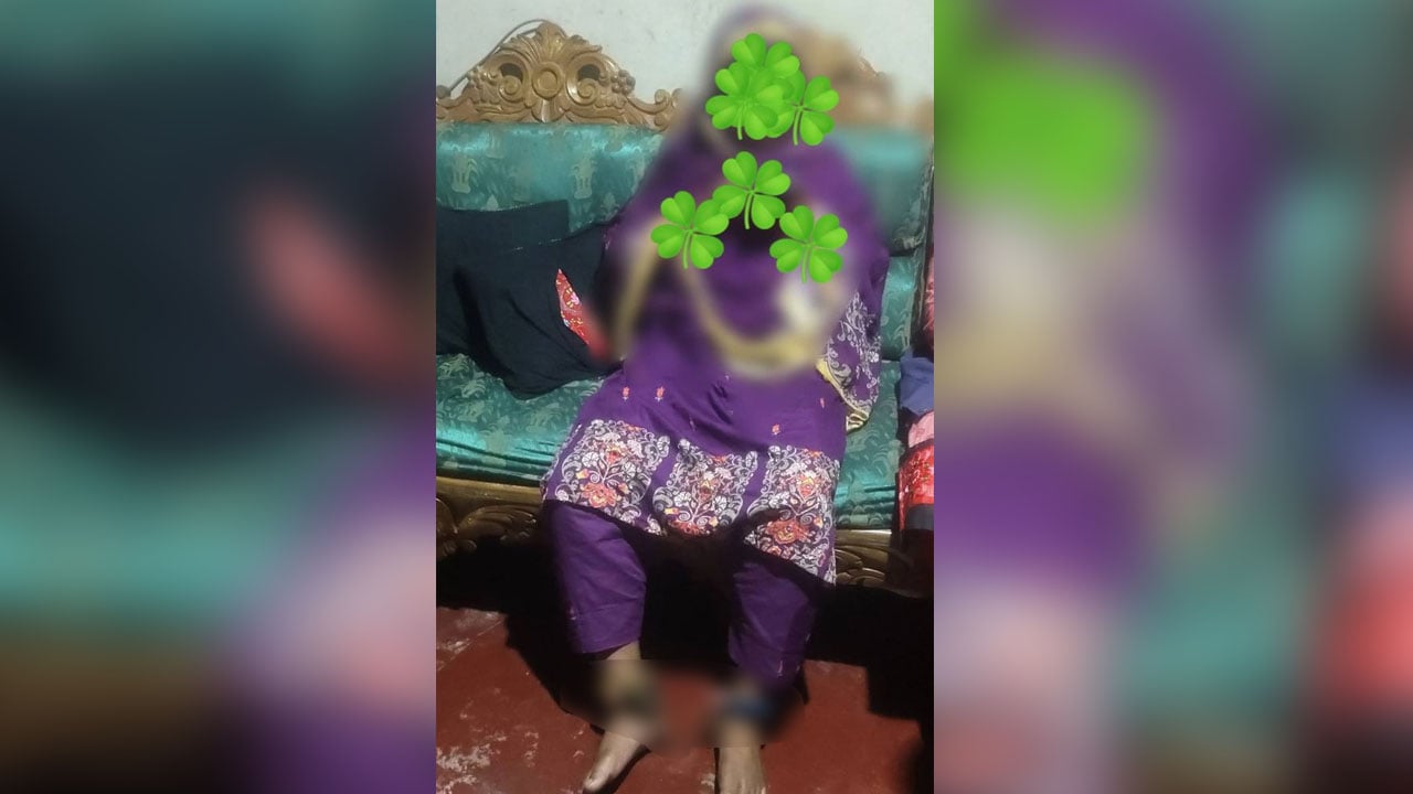 পায়ে শিকল পরা ঢাবির সাবেক ছাত্রী উদ্ধার, পরিবারের দাবি মানসিক রোগী