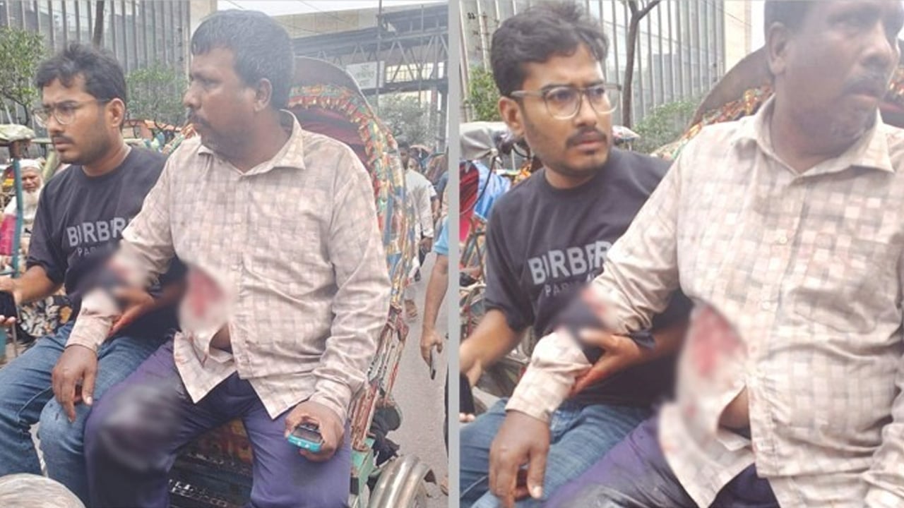 মতিঝিলে দিনদুপুরে ব্যবসায়ীকে গুলি করে ১৭ হাজার ডলার ছিনতাই