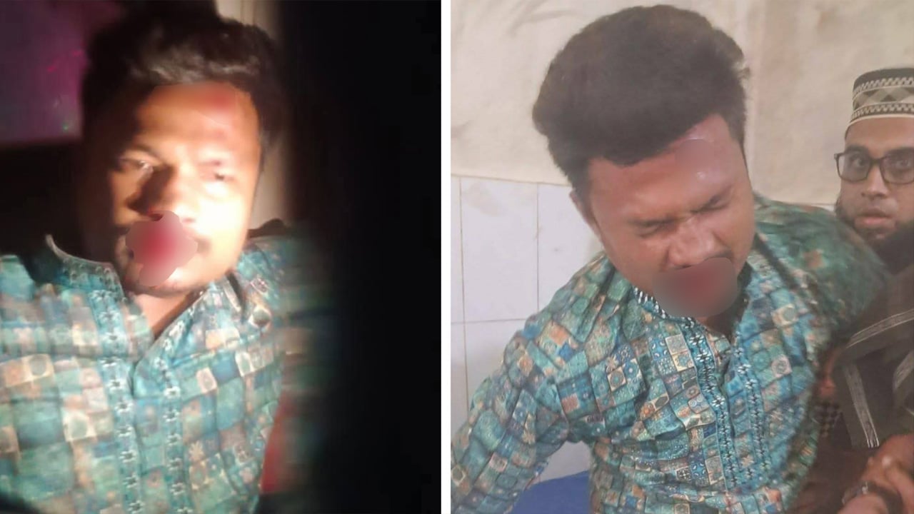 উখিয়ায় জামায়াত নেতার ওপর ছাত্রদল নেতাকর্মীর হামলা