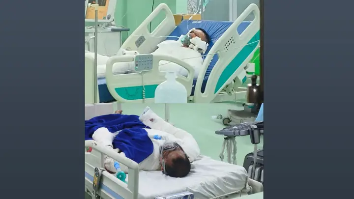 মিরসরাই ইকোনমিক জোনে ফার্নেস দুর্ঘটনা, চীনা নাগরিকসহ আহত ৪