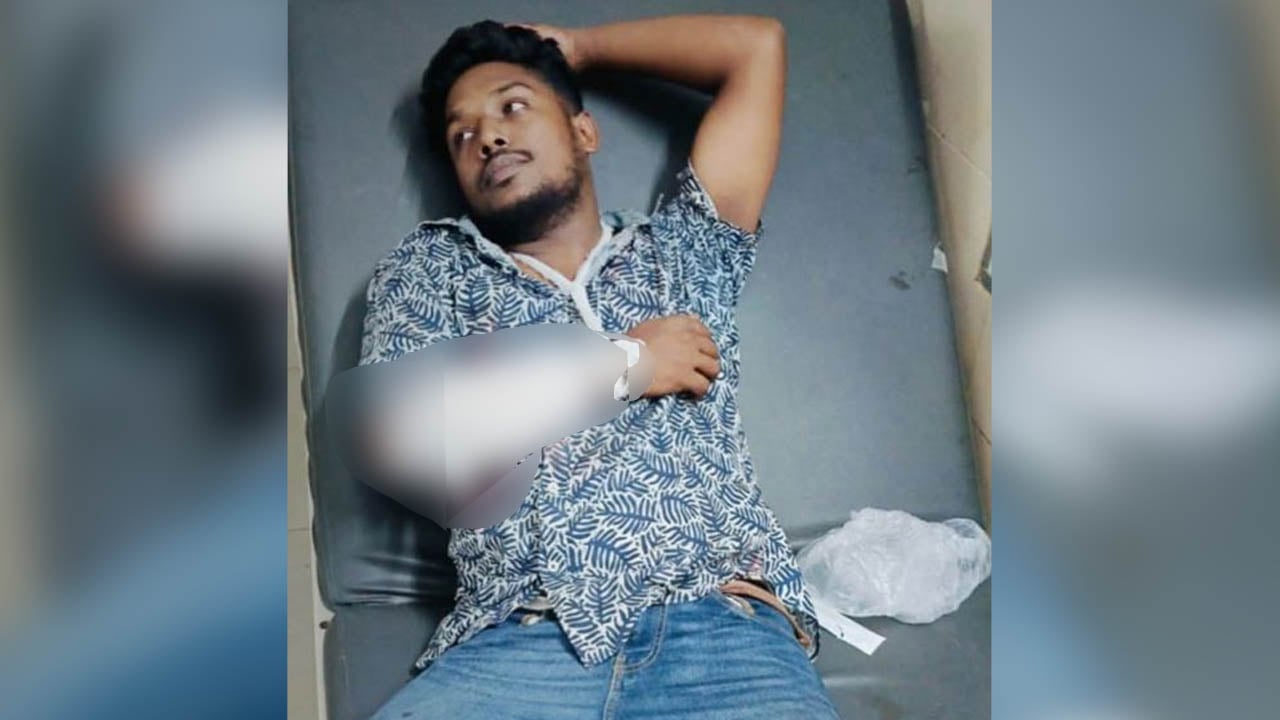 পটিয়ায় ভিডিও ফটোগ্রাফারকে চাইনিজ কুড়াল দিয়ে কুপিয়ে ছিনতাই, আহত ২