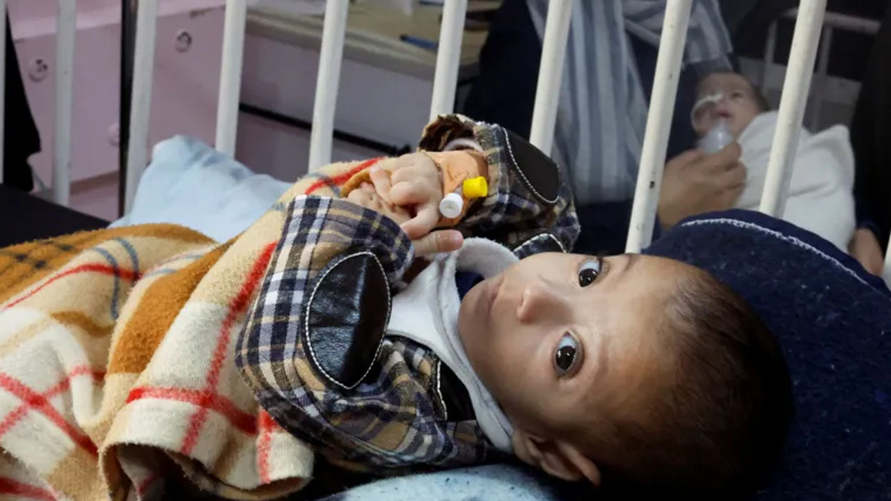 গাজায় প্রতি ১০ শিশুর মধ্যে একজন অপুষ্টির শিকার