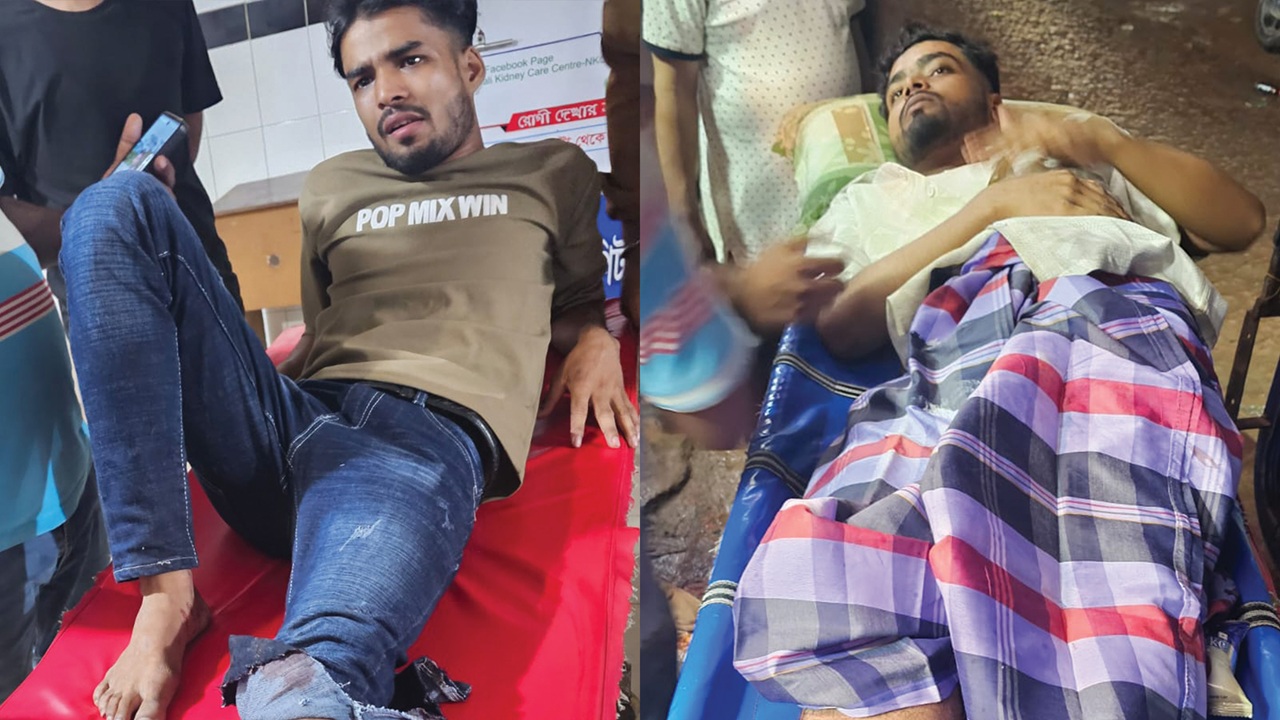 ফুটবল খেলা দেখাকে কেন্দ্র করে জামায়াতের ২ কর্মী গুলিবিদ্ধ