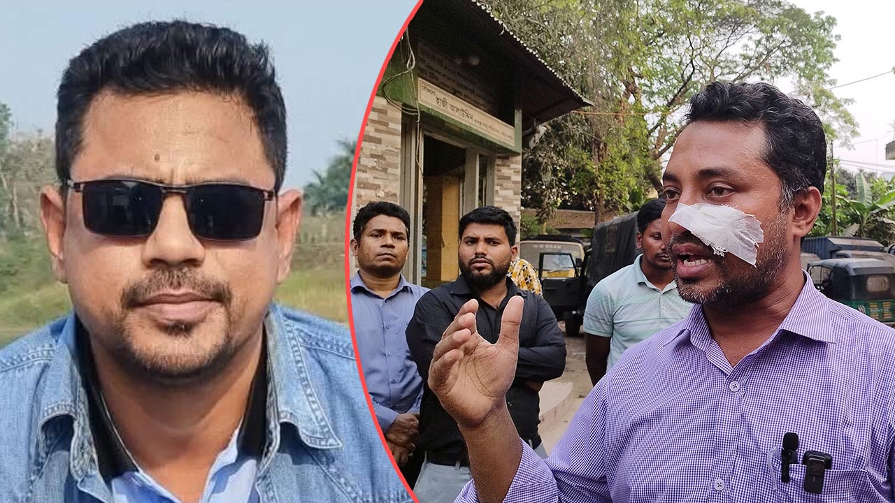 টাকা না পেয়ে ব্যাংক কর্মকর্তার নাক ফাটালেন ছাত্রদল নেতা