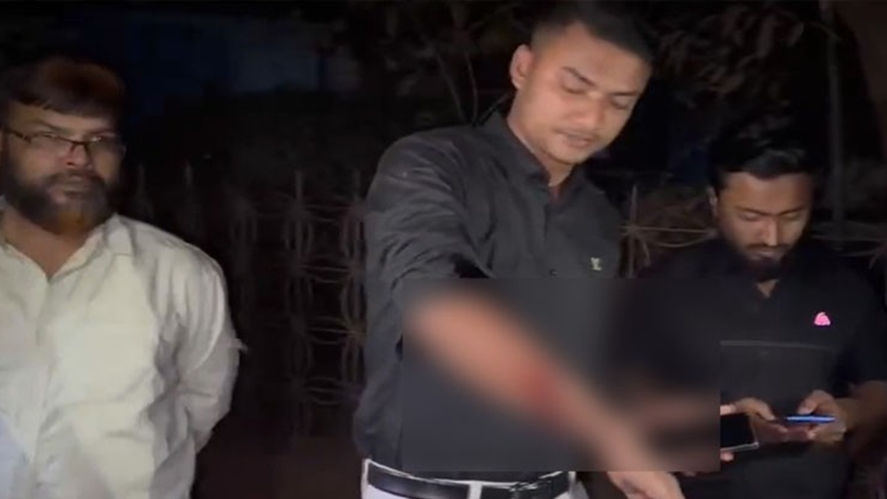 মোটরসাইকেলে এসে শিক্ষার্থীদের ওপর গুলি, আহত ১