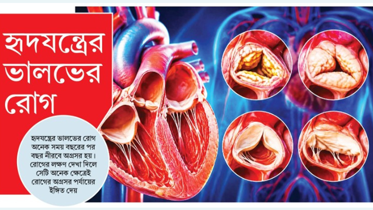 হৃদযন্ত্রের ভালভের রোগ