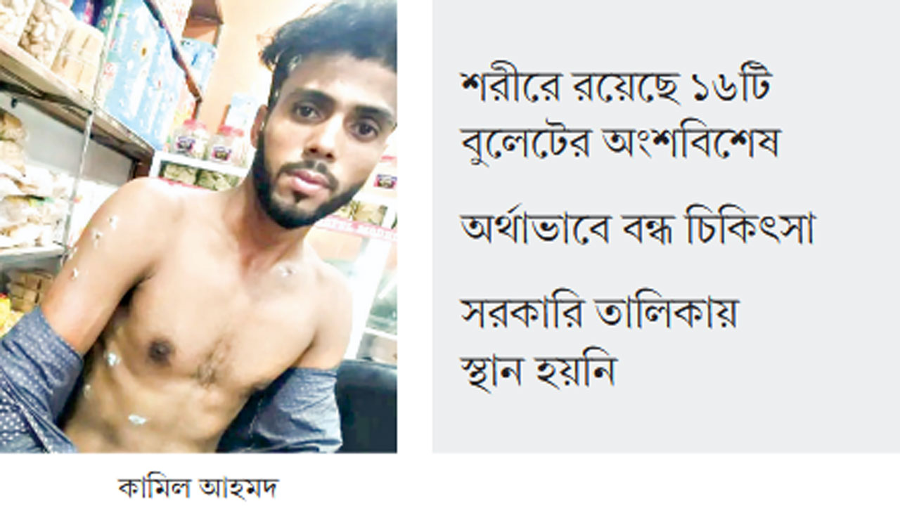 বুলেটের ক্ষত নিয়ে বিছানায় পড়ে আছেন কামিল