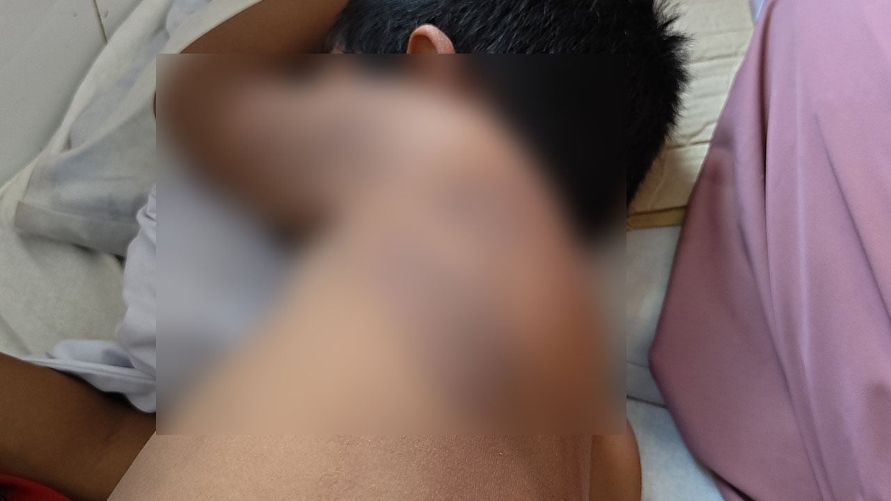 শরণখোলায় মাদরাসা শিক্ষকের মারধরে শিশু ছাত্র আহত, থানায় অভিযোগ