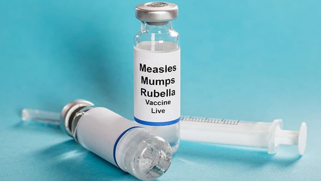 কাদের হামের টিকা নিতে হবে না, জানালেন বিশেষজ্ঞ চিকিৎসক