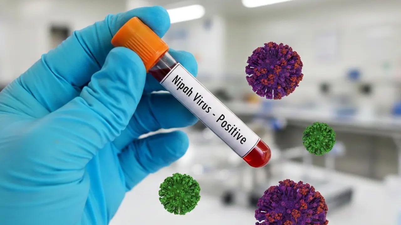 নওগাঁয় নিপাহ ভাইরাসে এক নারীর মৃত্যু