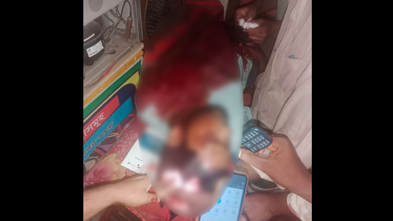 নিষিদ্ধ আ. লীগের হামলায় জামায়াত নেতা আহত, থানায় গিয়ে এমপির বিক্ষোভ