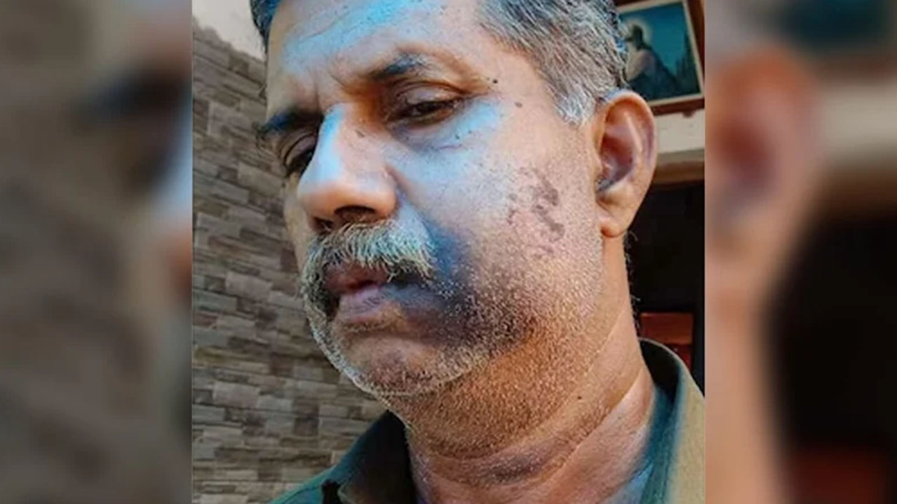 চড়ের প্রতিশোধ নিতে ৫০ বছর অপেক্ষা!