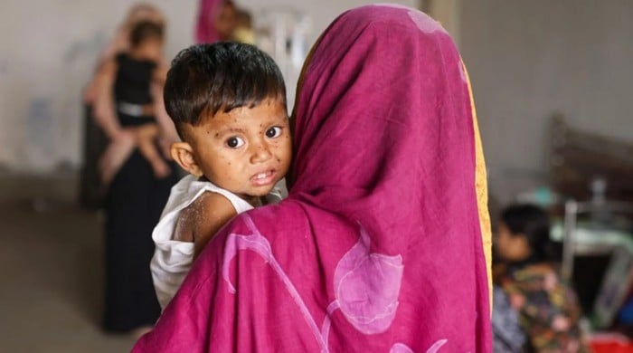 গত ২৪ ঘণ্টায় হাম ও উপসর্গ নিয়ে ১০ শিশুর মৃত্যু