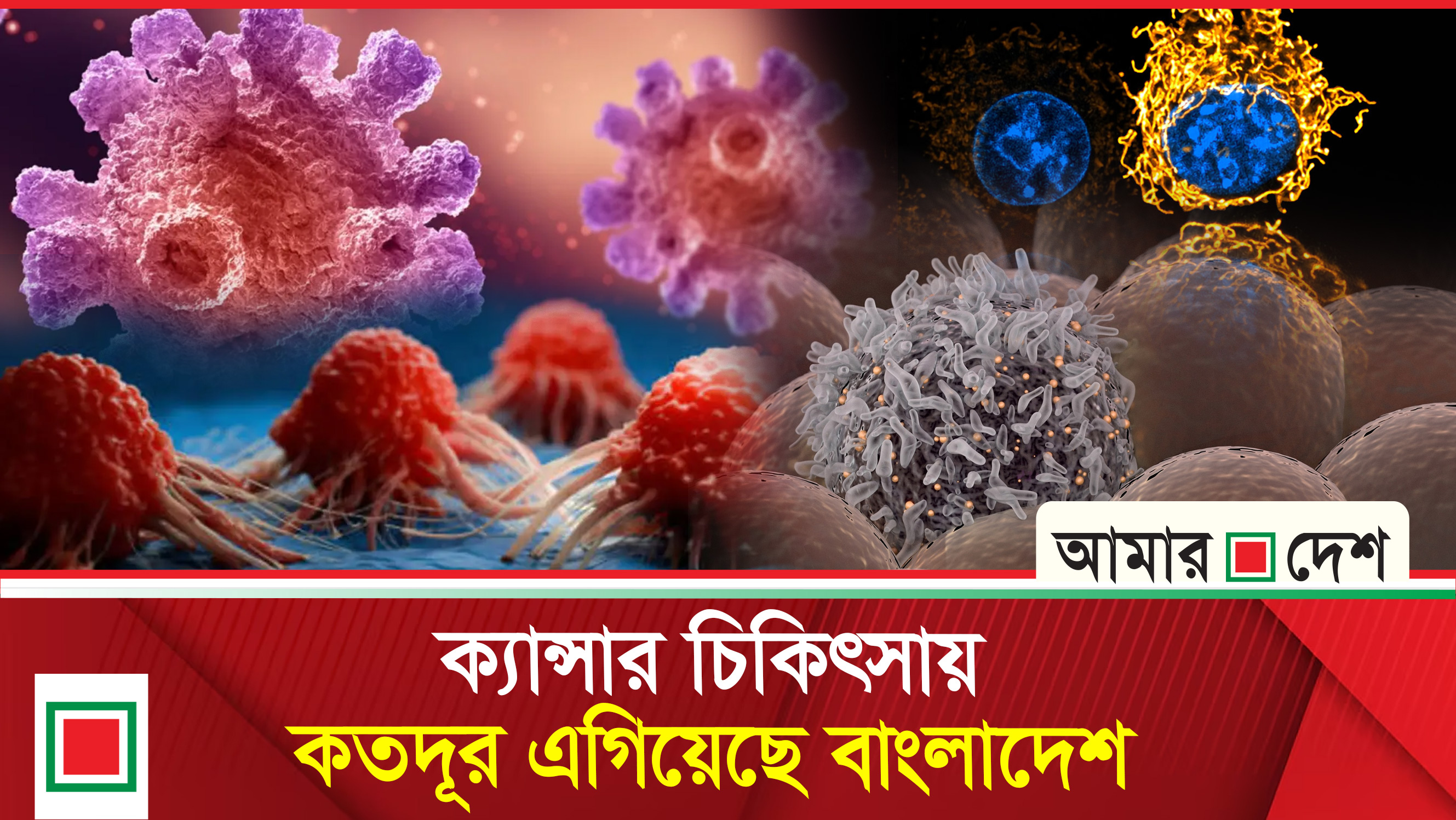 ক্যান্সার চিকিৎসায় বিশ্বের তুলনায় অনেক পিছিয়ে বাংলাদেশ