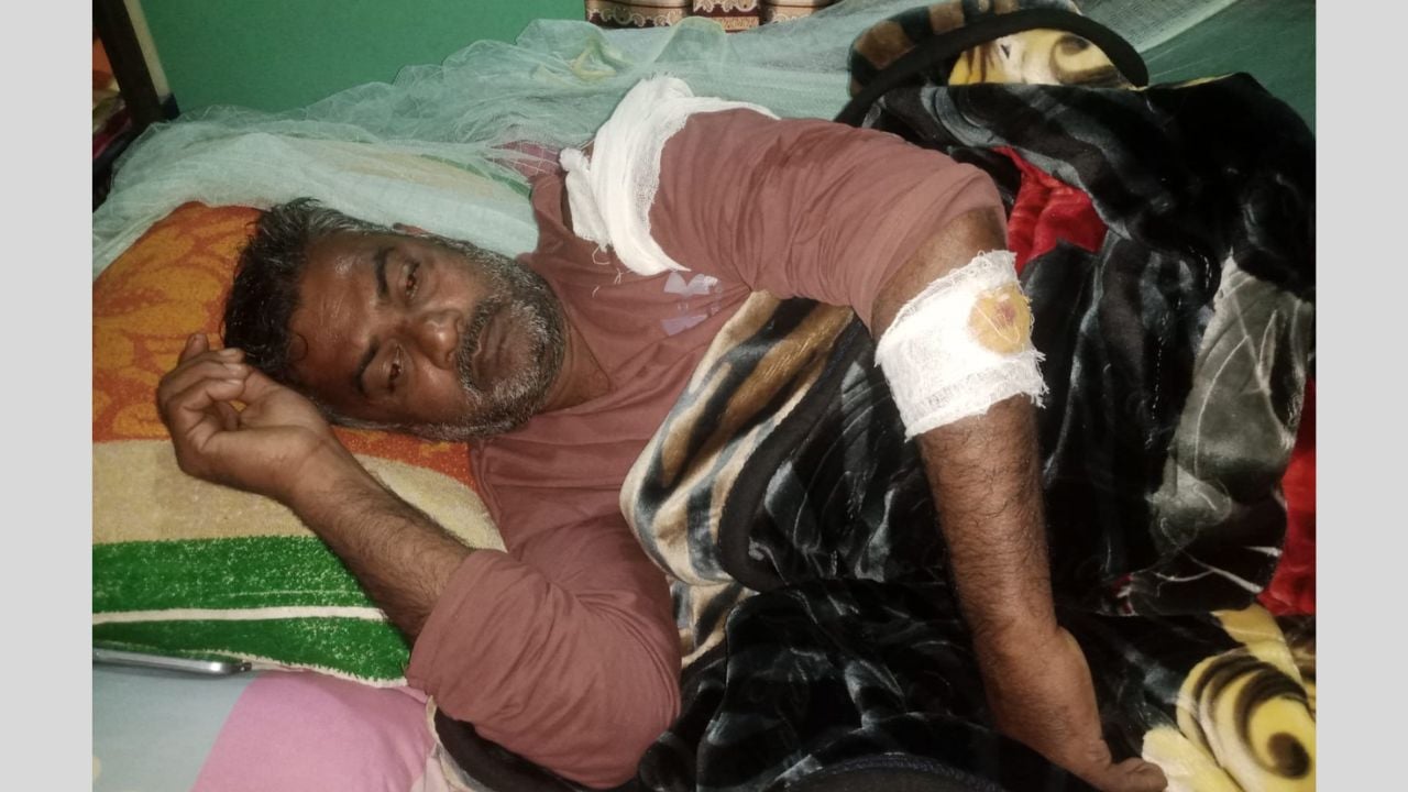 বাগাতিপাড়ায় বিএনপি কর্মীর হামলায় জামায়াত কর্মী আহত