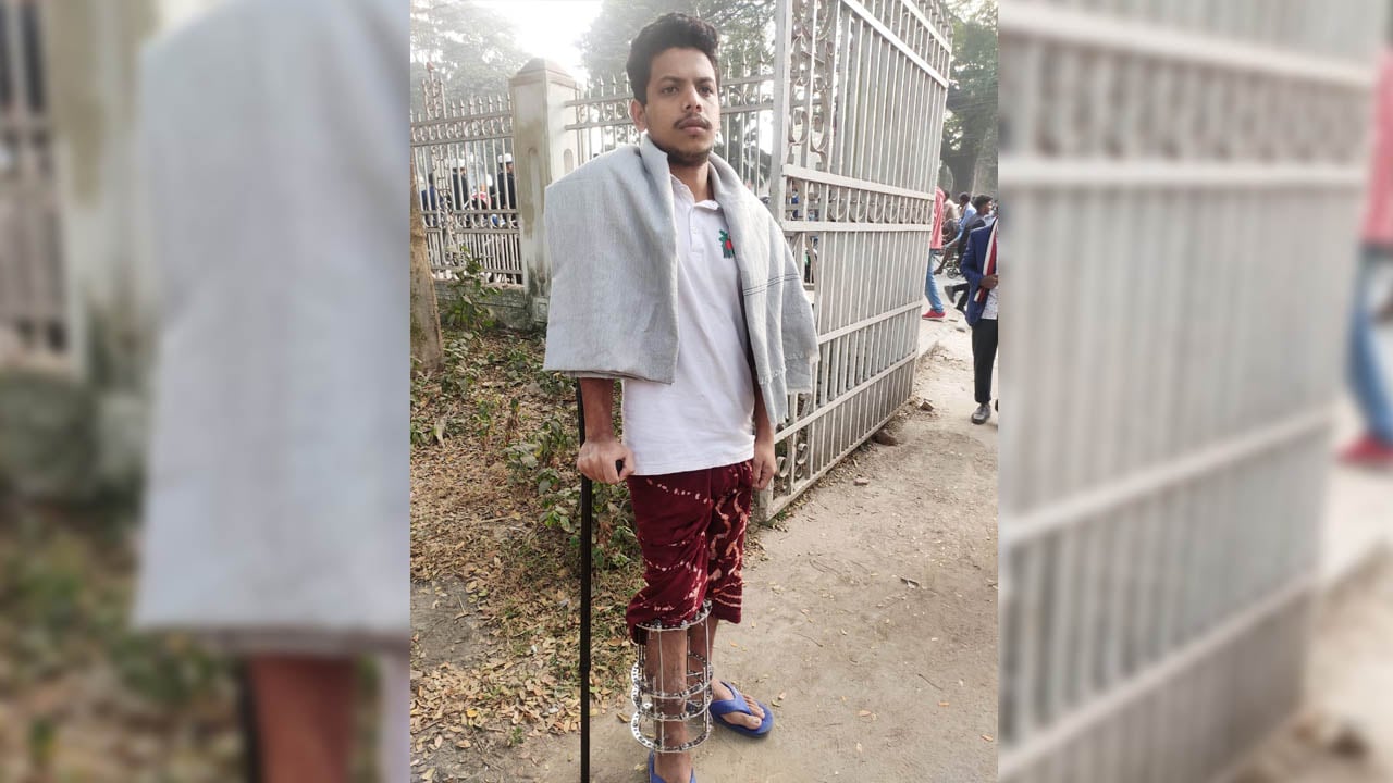 গণঅভ্যুত্থানে আহত ফয়সার শেখ হাসিনার বিচার চান