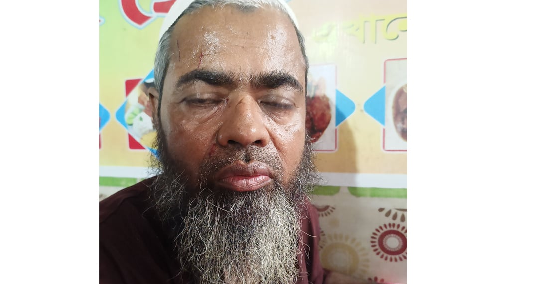 নামাজে যাওয়ায় কর্মচারী নেয়ামতকে পেটালেন প্রধান শিক্ষক অখিল