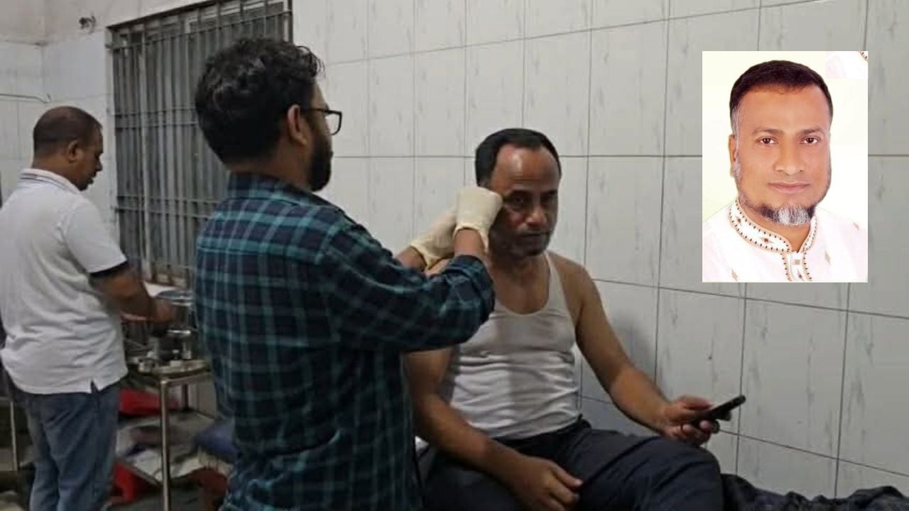 নরসিংদীতে ব্যবসায়ীর কান কামড়ে দিল বিএনপি নেতা, এলাকা ছাড়ার  নির্দেশ