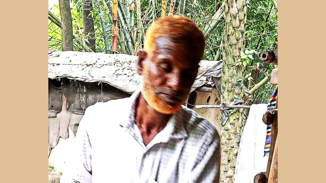 আমের আঁটি শ্বাসনালিতে আটকে এক ব্যক্তির মৃত্যু