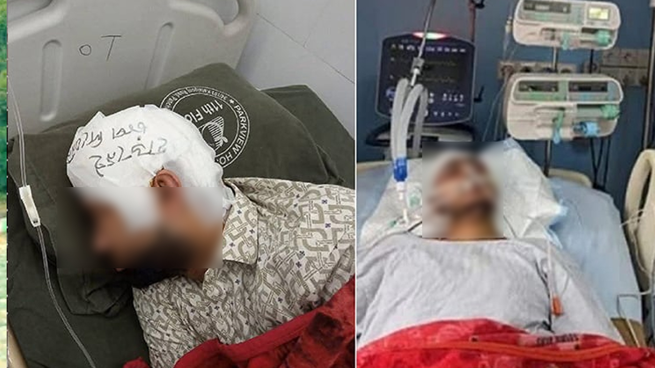 মামুনের খুলি ফ্রিজে, মাথার ব্যান্ডেজে লেখা ‘হাড় নেই, চাপ দিবেন না’