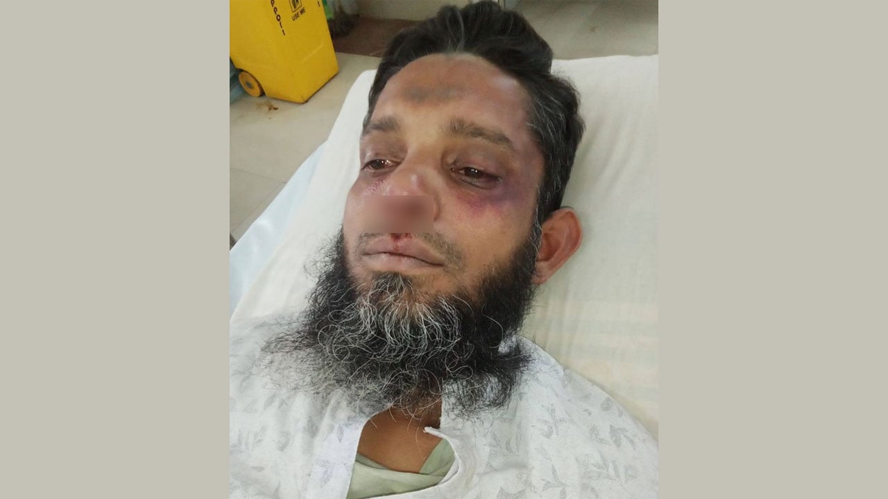 জামায়াত কর্মীকে পিটিয়ে জখম বিএনপি নেতার