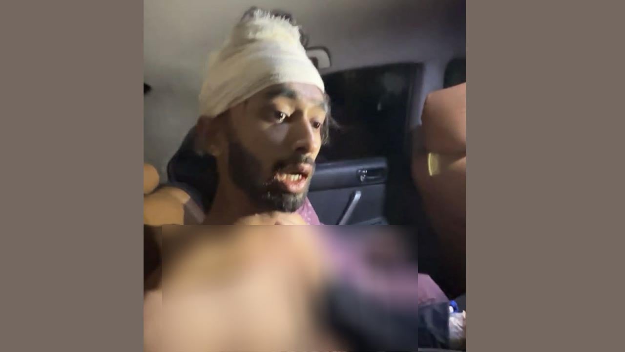 চাটখিলে ছাত্রদল কর্মীকে কোপালো আ.লীগের নেতাকর্মীরা