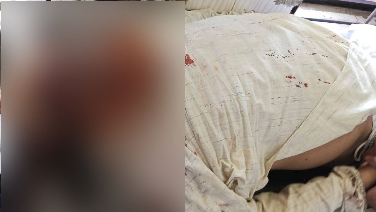 পাথর বোঝাই ট্রলির ধাক্কায় শ্রমিক কল্যাণ ফেডারেশন নেতা নিহত