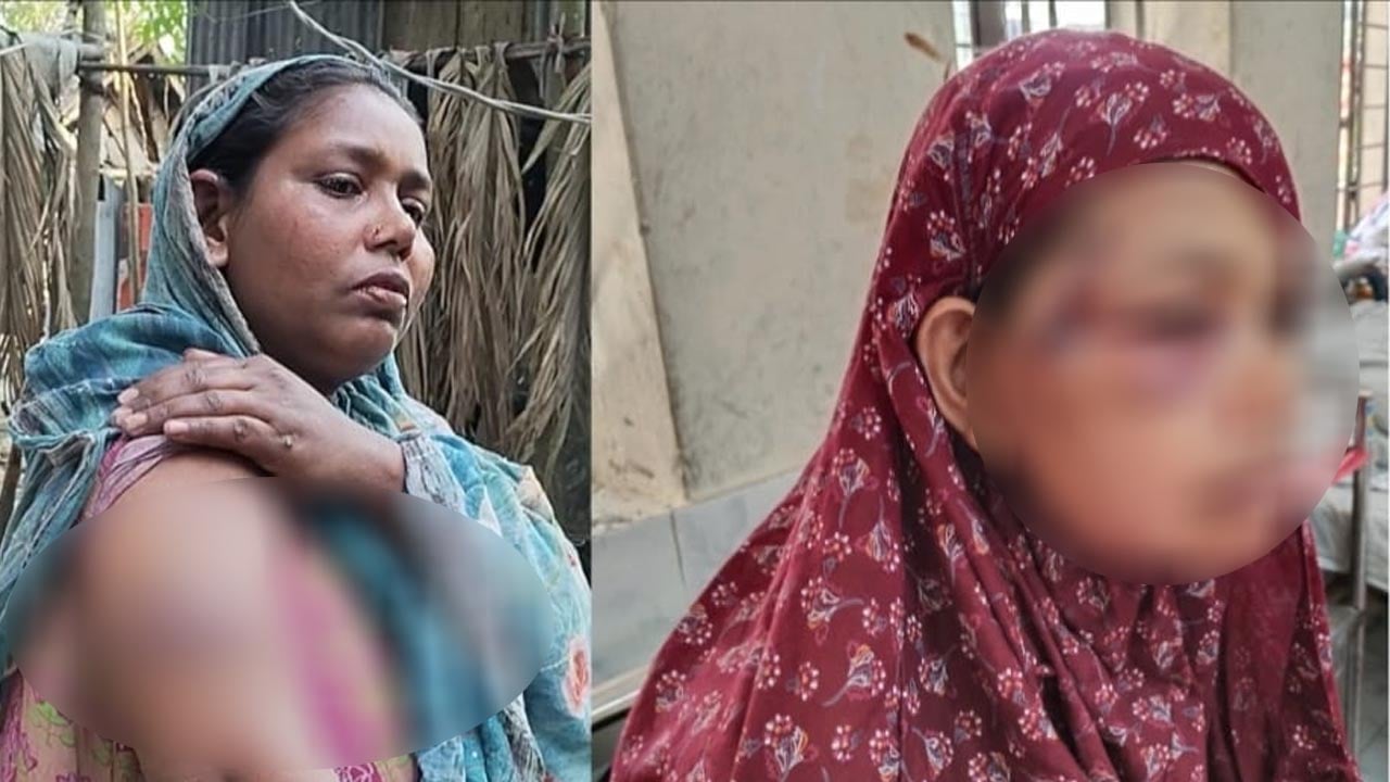 দাঁড়িপাল্লায় ভোট দেওয়ায় তিন নারীকে পিটিয়ে আহত, মামলা দায়ের