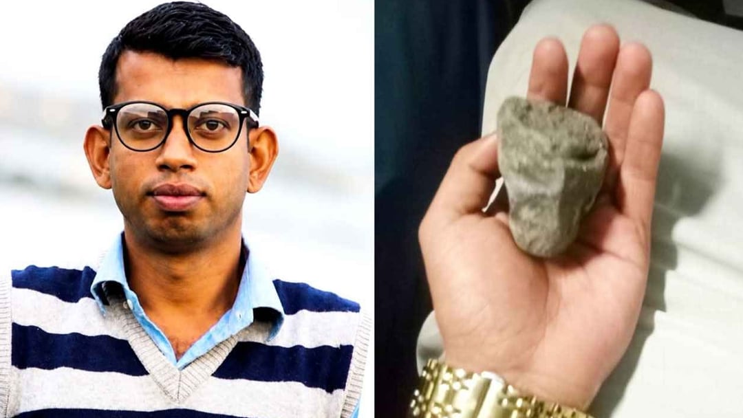 ট্রেনে ছোড়া পাথরে দৃষ্টি হারালেন আইনজীবী
