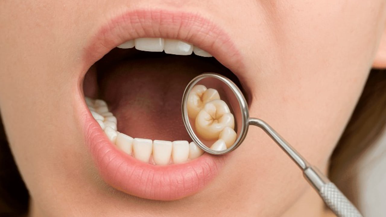 আক্কেল দাঁত কী কখনও তুলে ফেলা উচিত