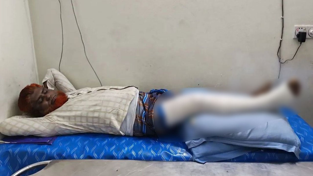 আমার দেশ’র হাজীগঞ্জ প্রতিনিধি সড়ক দুর্ঘটনায় গুরুতর আহত