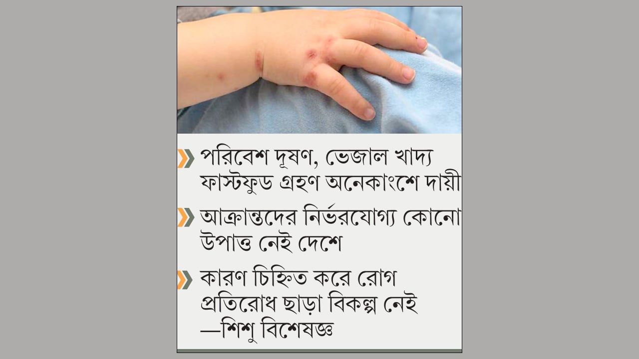 অসংক্রামক রোগে আক্রান্ত হচ্ছে দেশের শিশুরা