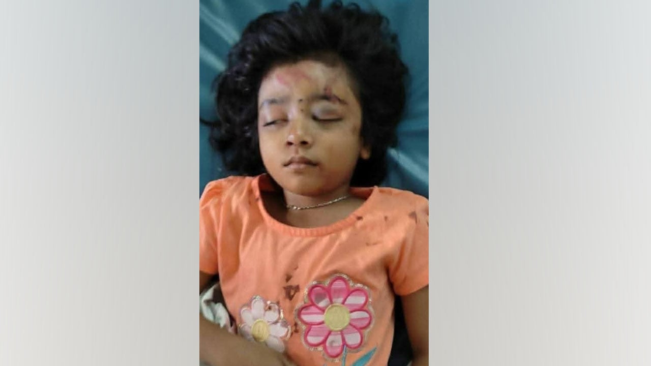 মাঝে মধ্যে জ্ঞান ফিরছে শিশু আরাধ্য’র