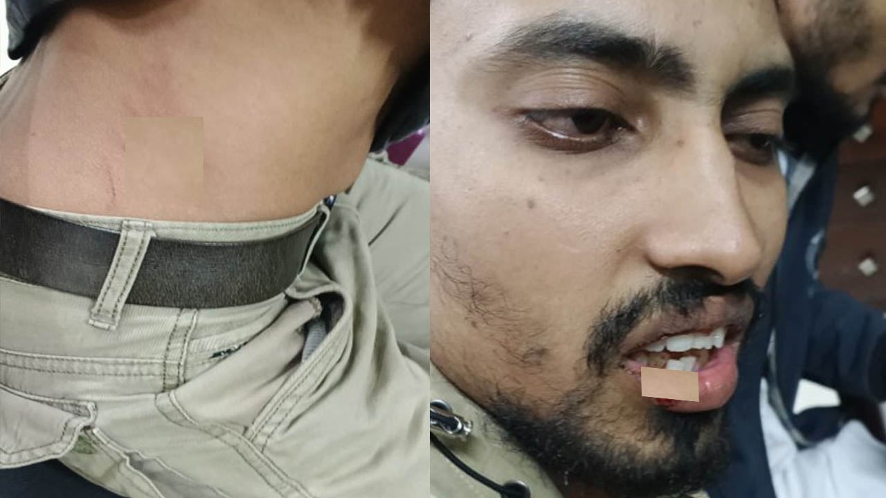 জামায়াত-এনসিপি সমর্থকদের ওপর সন্ত্রাসী হামলা