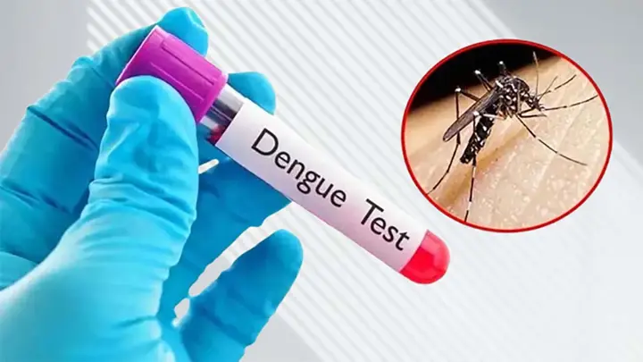 ডেঙ্গু পরীক্ষায় ৫ লাখ কিট দিয়েছে যুক্তরাষ্ট্র