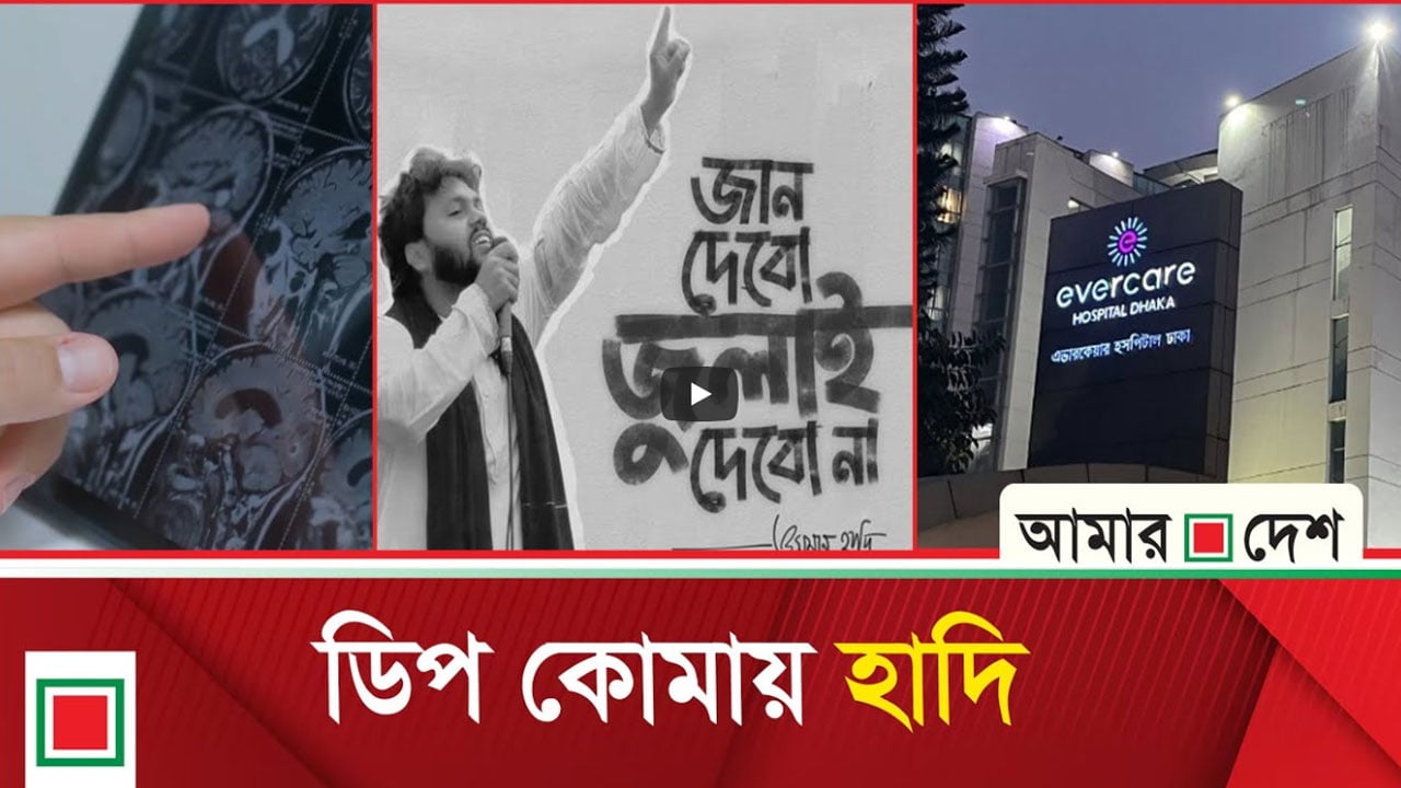 উন্নত চিকিৎসায় হাদিকে সিঙ্গাপুর পাঠানো হচ্ছে