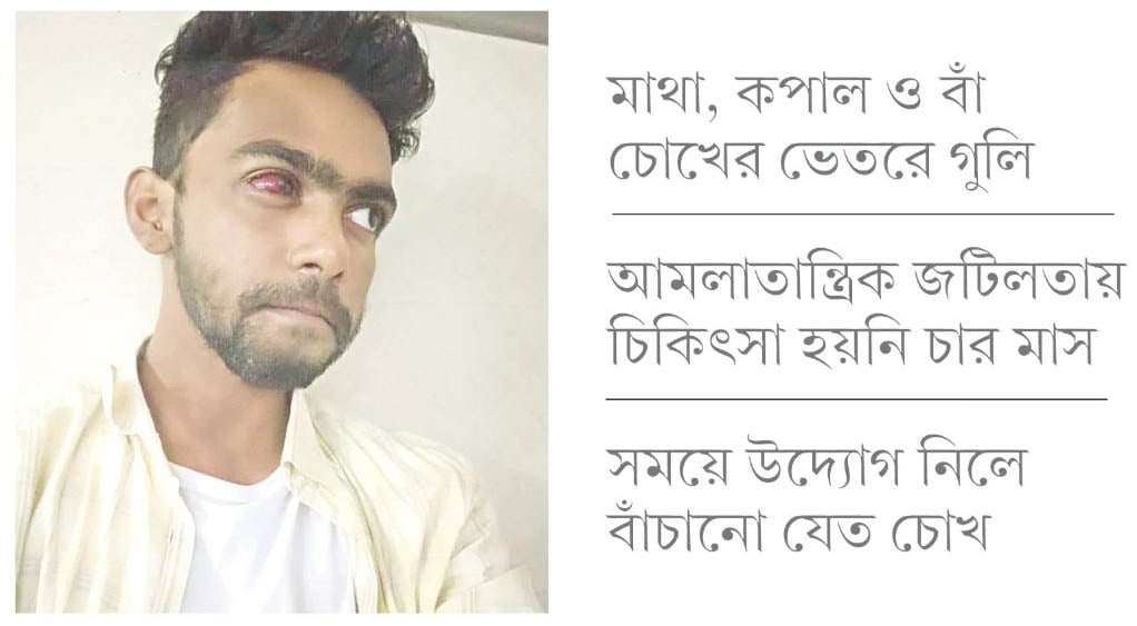 ছররা গুলি কেড়ে নিয়েছে শাফিলের বাম চোখ