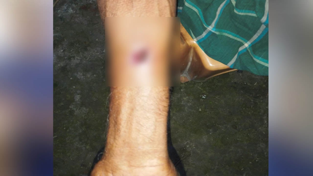 ধামইরহাটে শিয়াল আতঙ্ক