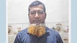 কালকিনিতে কৃষকের দুই পায়ের রগ কেটে দিল দুর্বৃত্তরা